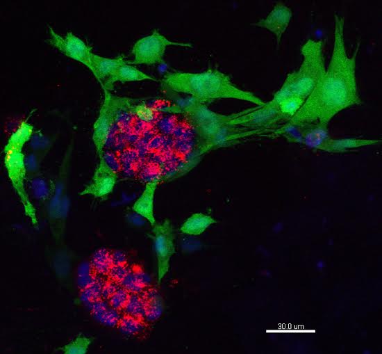 Cancro al seno, un gel potrebbe limitare l'uso degli animali nella ricerca