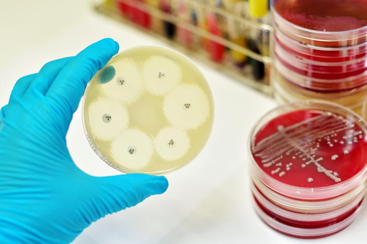 Antibiotico resistenza: “Target più ambiziosi per tutelare la salute”