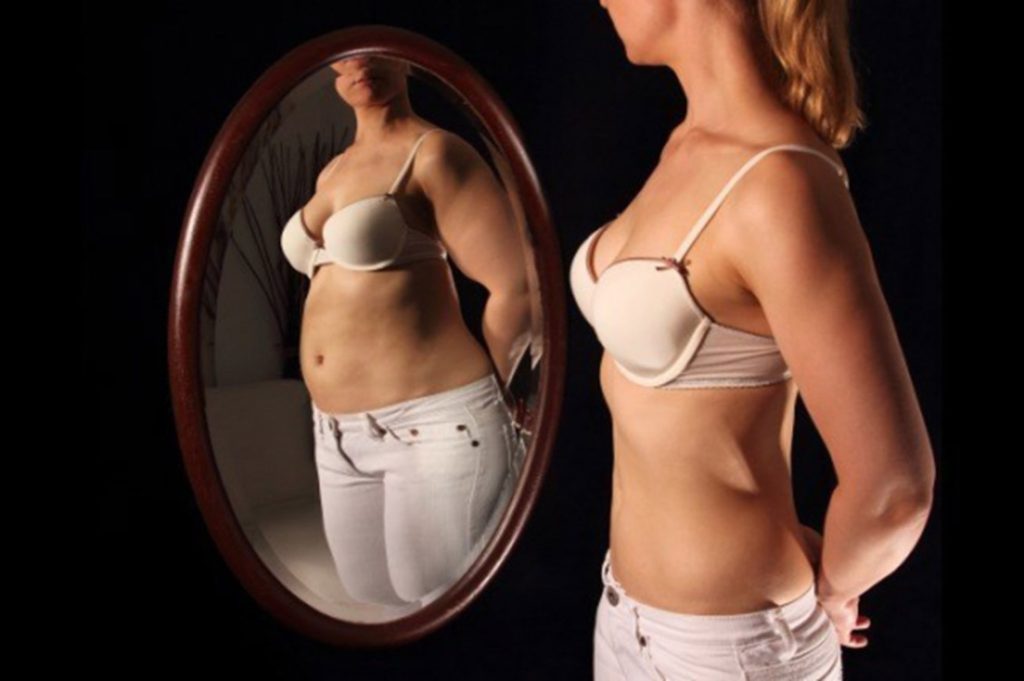 anoressia