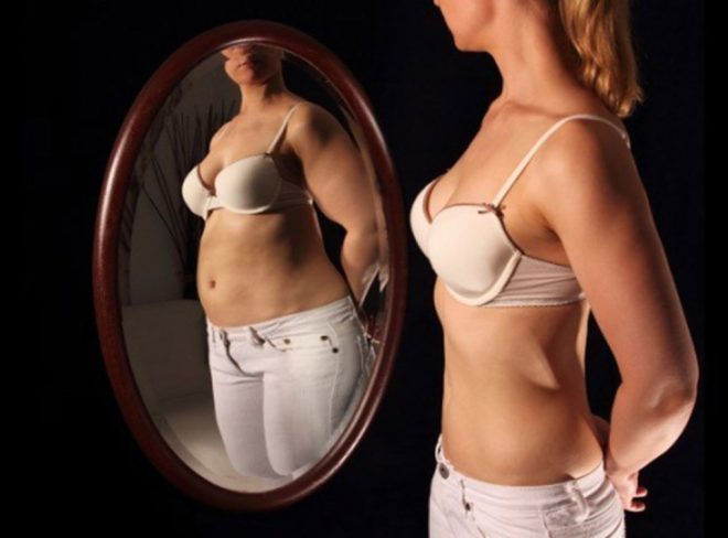 anoressia