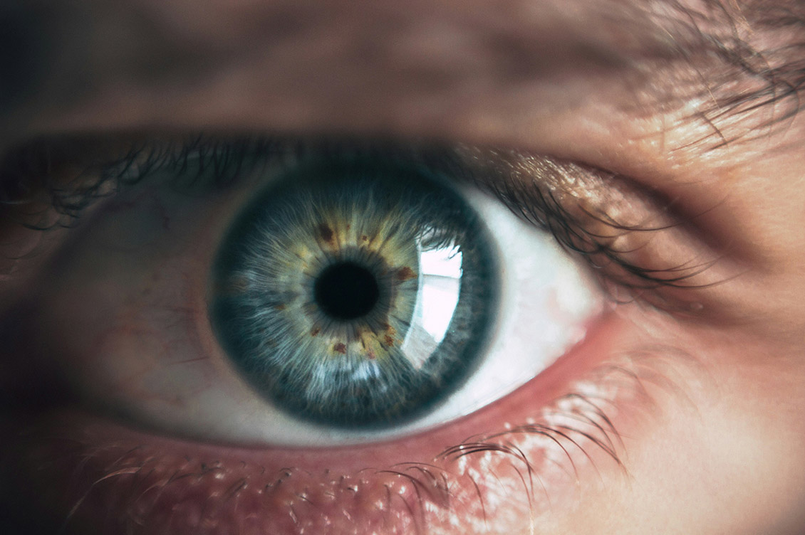 iride intelligenza artificiale