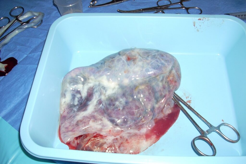 Placenta